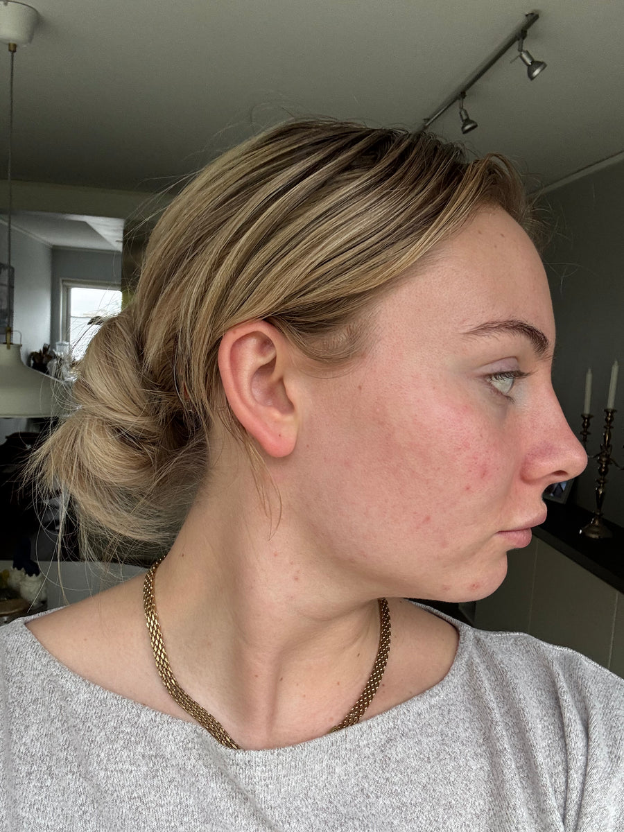Efter behandling